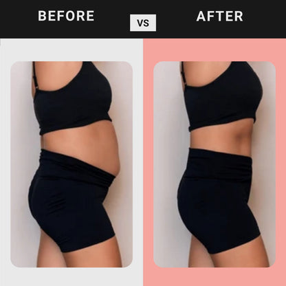 VITAGLOW-GLP 1 PATCHES